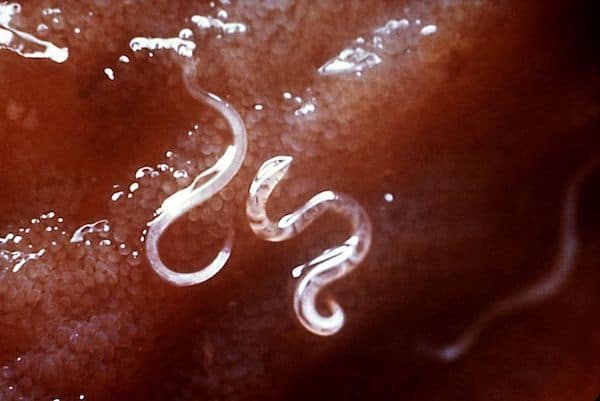 hookworm